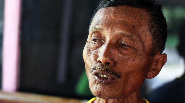 Sadiyo Cipto Wiyono (65), pemulung yang kerap menambal jalan berlubang di Sragen, Jateng. (Liputan6.com)