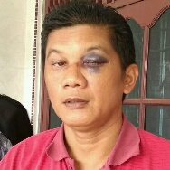 Abdul Gafar Korban Penganiayaan Oleh Anggota DPRD Desak Polisi Tahan Pelaku