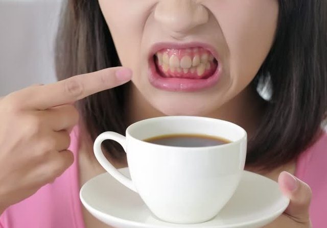 Ketahui Dampak Rutin Minum Kopi Pada Kesehatan Gigi dan Solusinya