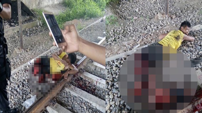 Terlindas Kereta Api Padang-Pariaman, Pria Ini Masih Hidup, Kondisinya Mengenaskan
