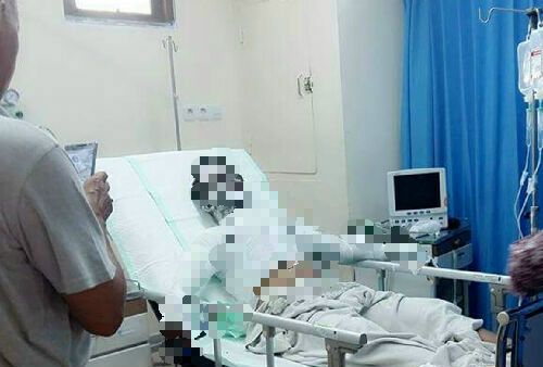 Korban Drum Meledak Akhirnya Meninggal Di RSUD Pekanbaru