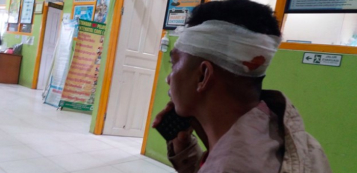 Aduh Duh... Sesama MC Dangdut Berkelahi, Gigi Palsu Copot dan Hilang