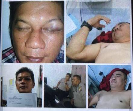 Anggota DPRD Riau Dari PKB Dilaporkan ke Polisi