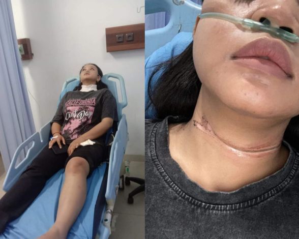 Kabel Fiber Optik di Pekanbaru Makan Korban, Pemko Lakukan Hal Ini