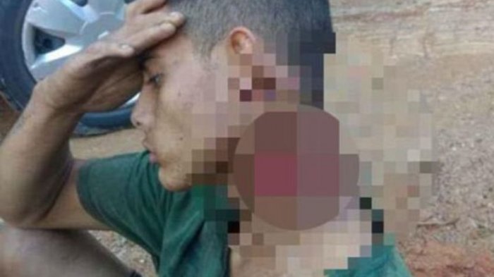 Leher Nyaris Putus, Remaja 18 Tahun Ini Masih Sanggup Berjalan Mencari Pertolongan