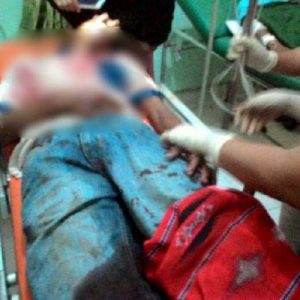 Warga Kaget Setelah Temukan 2 Pemuda Inhil Berlumuran Darah Ditengah Gelap Malam Hari