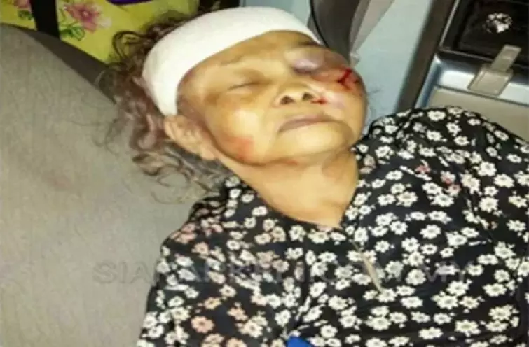 Curi Dua Jagung, Nenek Ini Dipukuli Hingga Babak Belur
