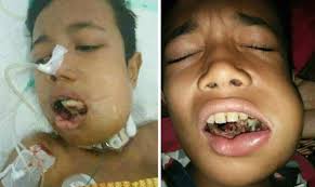 Hamzah Putra, Penderita Kanker Mulut Hembuskan Nafas Terakhir