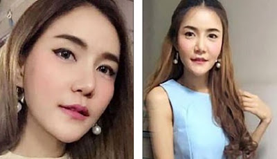 Gara-gara Gaya Pakaiannya, Perawat Cantik Dipaksa Mengundurkan Diri