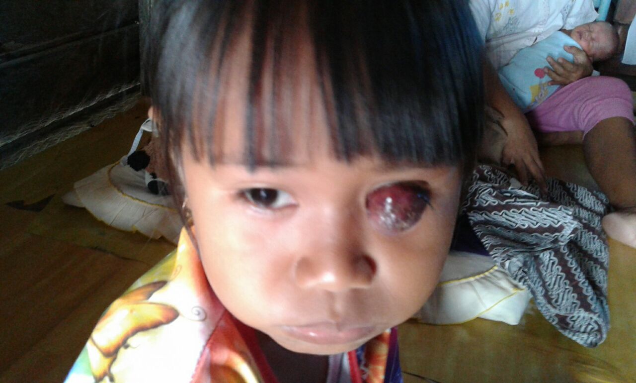 HIPPMATAMAH Galang Dana Untuk Elis