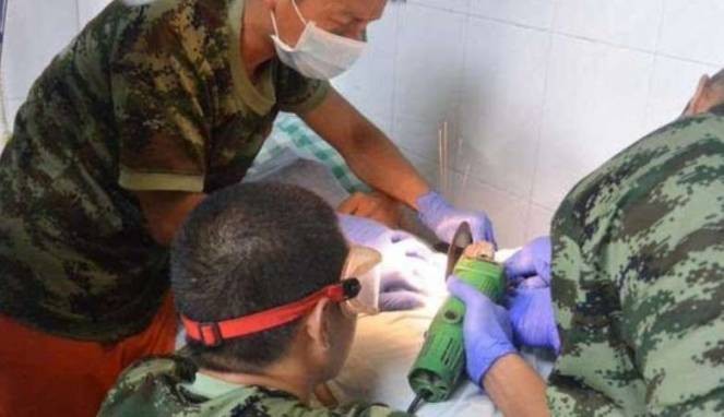 Alat Vital Terjepit Kunci, Pria China Nyaris Frustrasi