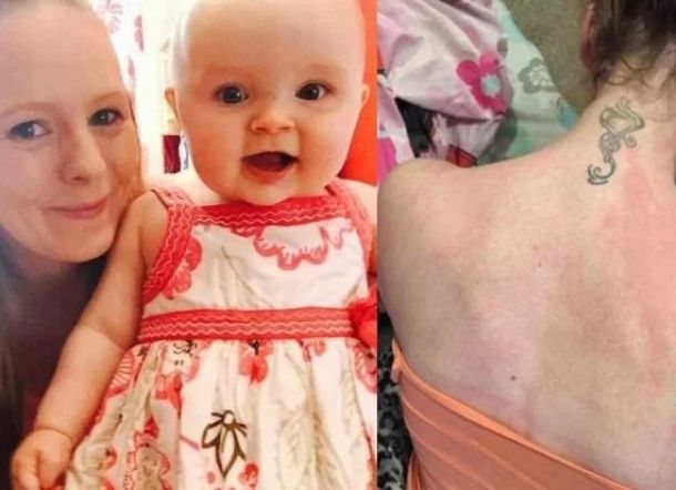 Gegara Hamil, Wanita Ini Alergi Air Hingga Keringatnya Sendiri