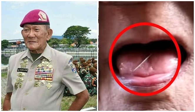 Djonie Liem, Veteran yang Mampu Menembakkan Jarum dari Mulutnya dengan Tepat Saaran