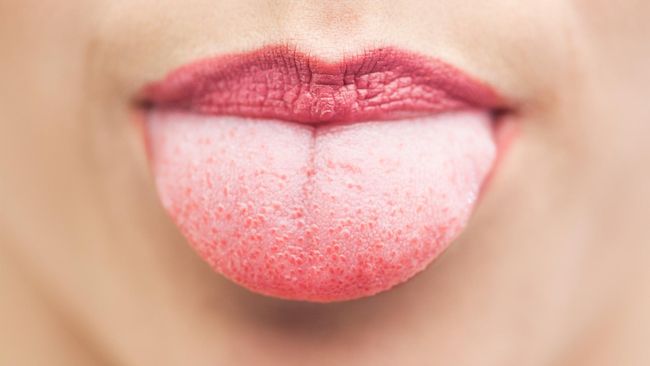 Sadis! Disuruh Cari Kerja, Suami Potong Lidah Istri