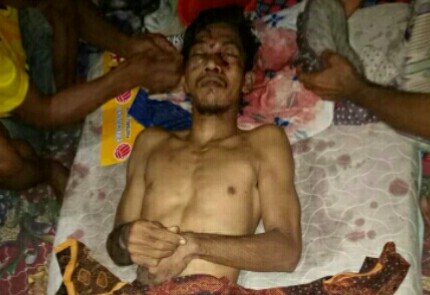 Seorang Pria Ditemukan Tak Bernyawa di Hutan