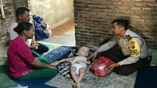 Zakaria, Bocah 6 Tahun Asal Pekanbaru Yang Mengalami Hydrocephalus
