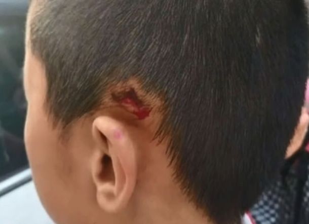 Guru SD Dipecat Setelah Menyeret dan Menghempaskan Siswanya ke Lantai