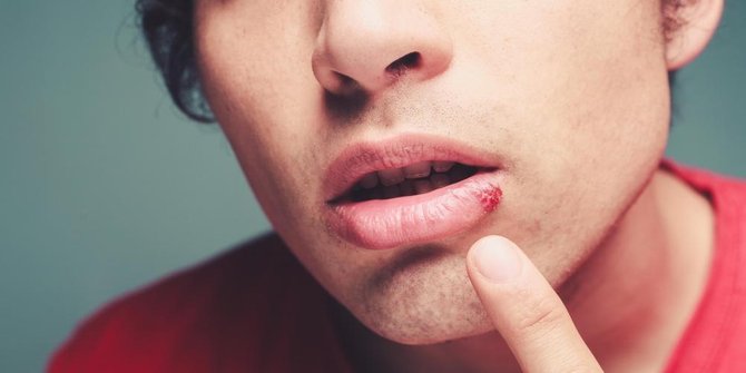 6 Tanda Ketika Levermu Dipenuhi Tumpukan Lemak Jahat