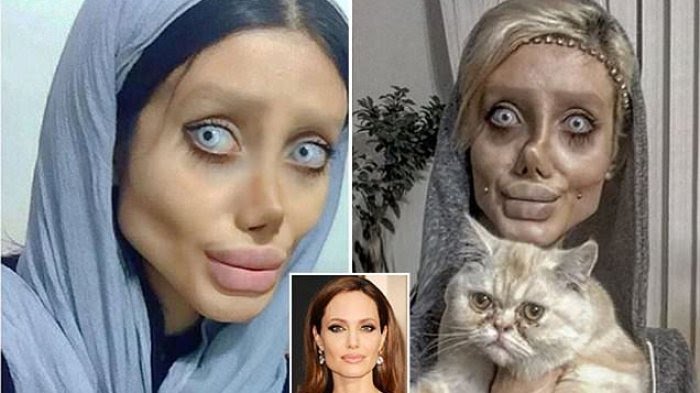 Niat Hati Rubah Wajah Seperti Angelina Jolie, Hasilnya Malah Seperti Zombie