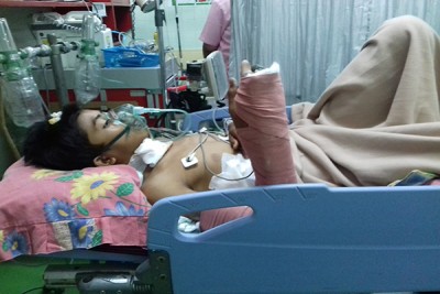 Kejar Monyet, Bocah SMP Jatuh dari Pohon, Tertusuk Ranting