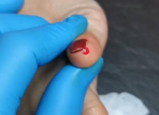 Dua Perempuan Digigit Tikus saat Nonton Bioskop, Satu Kelingkingnya Berdarah