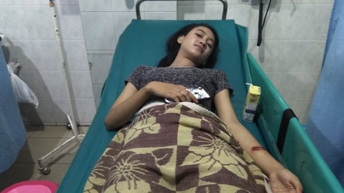 Mahasiswa Cantik ini Luka Parah Usai Tabrak Kantin Kampus, Begini Ceritanya...