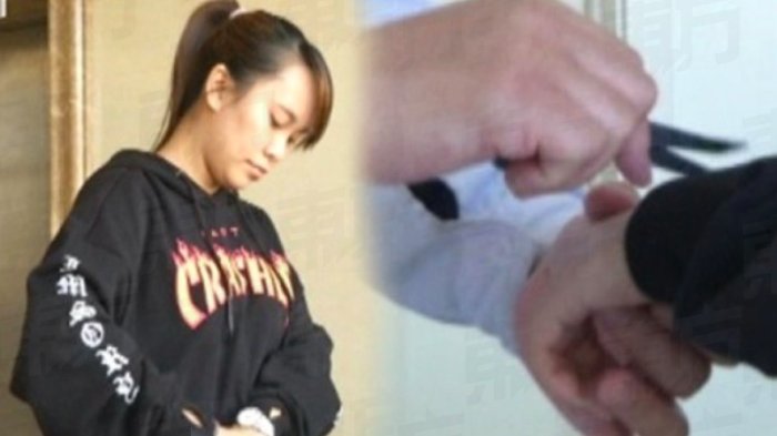 Tidur di Meja dengan Posisi Begini, Wanita Ini Derita Kerusakan Syaraf