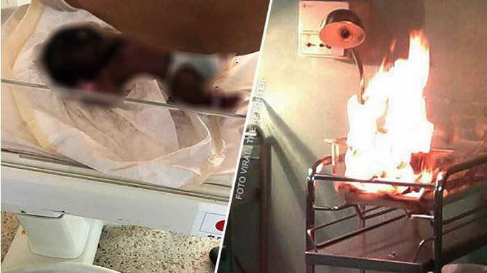 Bayi Baru Lahir Ini Tewas Terbakar di Inkubator Rumah Sakit, Ini Fotonya