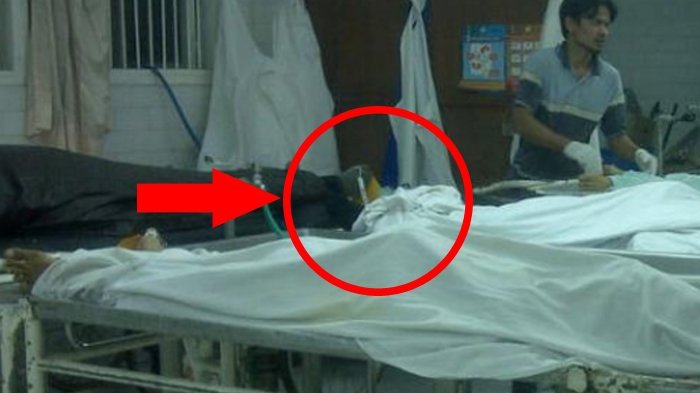 Pria ini Tewas Usai Bercinta Diduga Overdosis Obat Kuat, Tapi 'Itu'-nya Masih Tegak