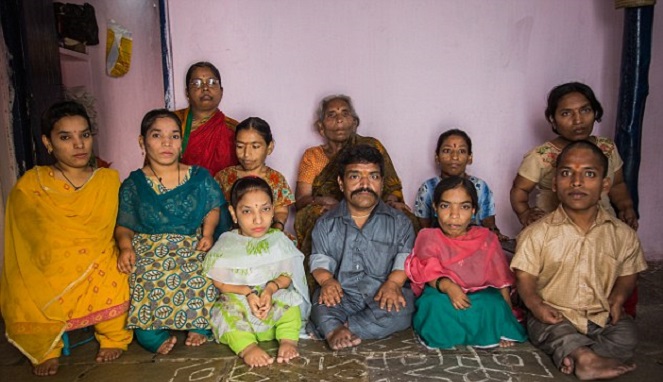 Satu Keluarga Bertubuh Kerdil, Kisah Mereka Menyayat Hati