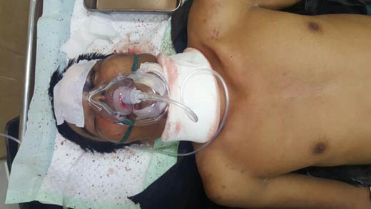 Cium dan Peluk Istri Orang, Duru Bonyok di Hajar Rekan Kerja