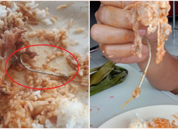 Wanita Ini Tak Sadar Hampir Menelan Kail Pancingan yang Masih Tertancap di Ikan