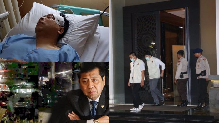 Fakta dan Kejanggalan Kecelakaan Setya Novanto