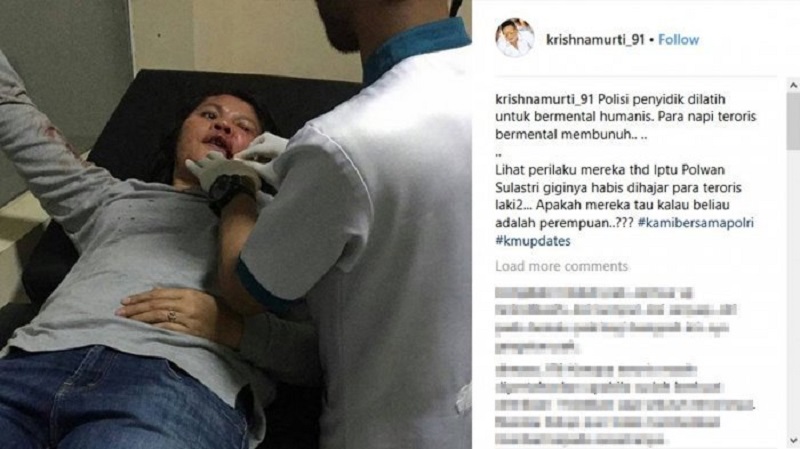 Polwan Cantik Ini Jadi Korban Rusuh di Mako Brimob, Giginya Rontok Dihantam Tabung Pemadam Api