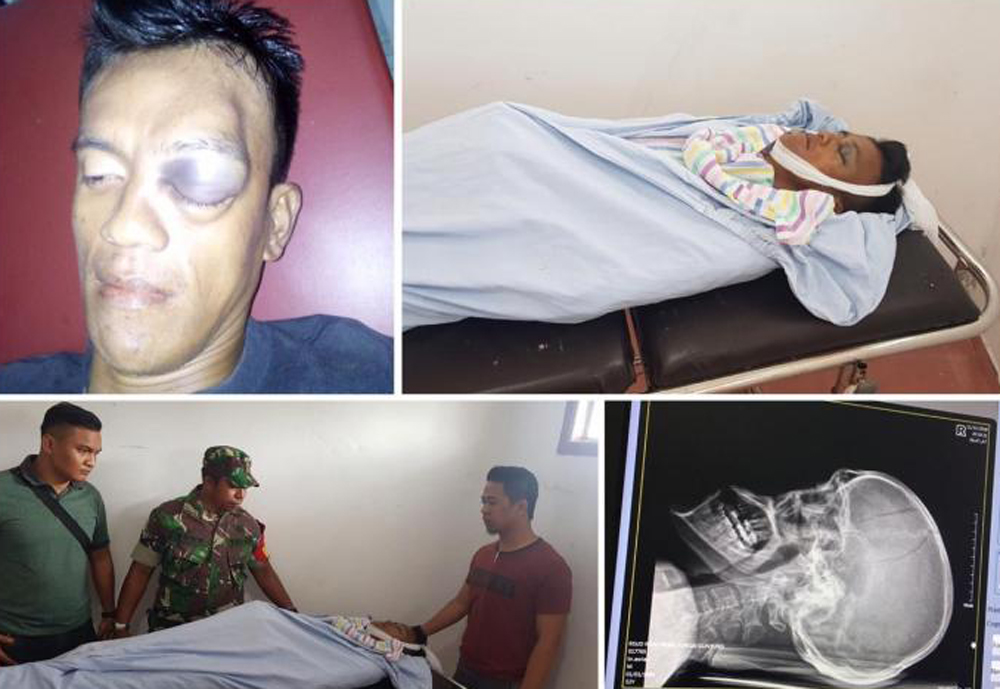 Cekcok Mulut, Pekerja di Inhil Tewas Dihantam Sebatang Kayu