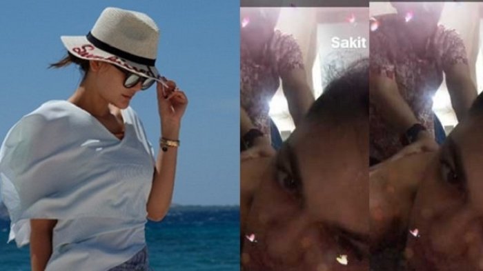 Penampakan Luna Maya Bertelanjang Dada Bikin Heboh, Sakit dan Lakukan Ini!