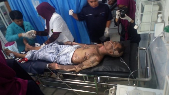 Diduga Berhutang, Ini Kronologis Pria Disiram Bensin Lalu Dibakar di Depan Umum
