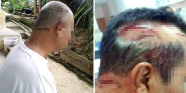 Suami Ingin Berpoligami, Istri Bacok Kepala Suami