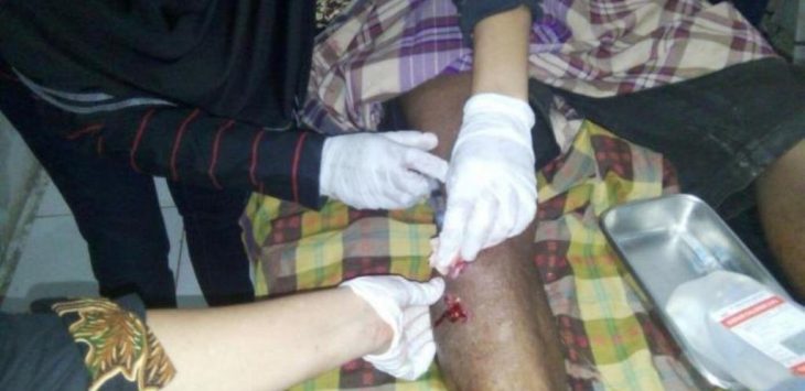 Buru ‘Manusia Siluman’, Pria ini Malah Diterkam Macan