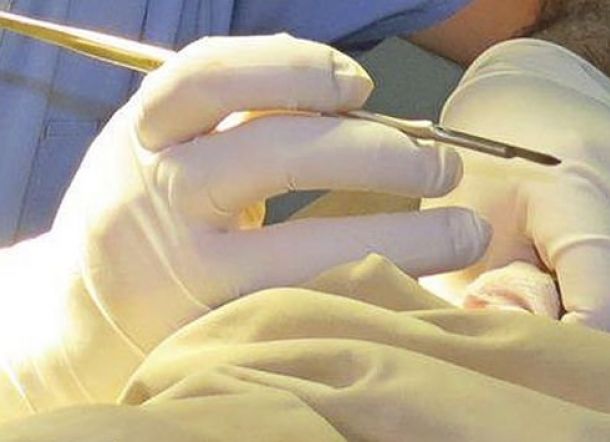 Balita Meninggal Saat Disunat, Dokternya Ditangkap