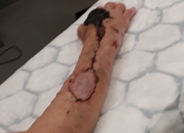 Gegara Dicakar Kucing, Nenek ini Koma dan Hampir Mati