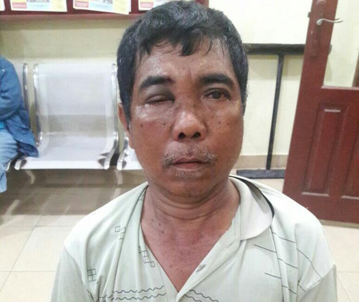 ANAK DURHAKA! Tak dikasih Uang, Ayah Dihajar Hingga Babak Belur