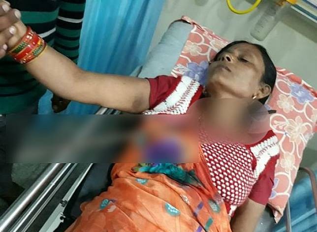 Wanita Ini Berhasil Selamat Meski Lehernya Tertembus Besi Sepanjang 1,5 Meter