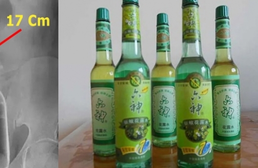 JANGAN DICONTOH! Pria Ini Garuk Bokong Pakai Botol, Begini Akibatnya...