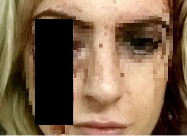 Kepala Dihantam Palu, Wanita Cantik Buta