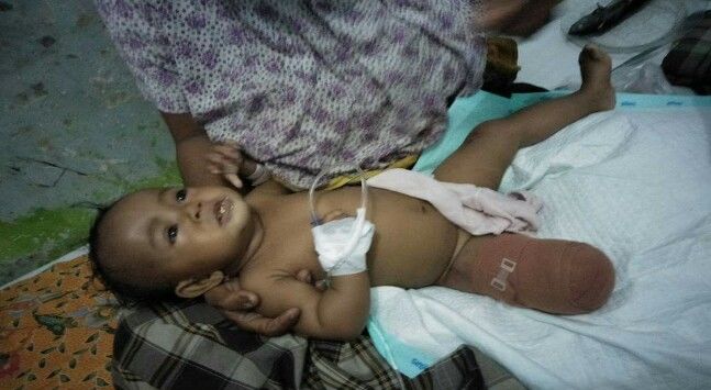 Kaki Bayi 6 Bulan Ini Putus setelah Gendongannya Terlilit Gir Motor