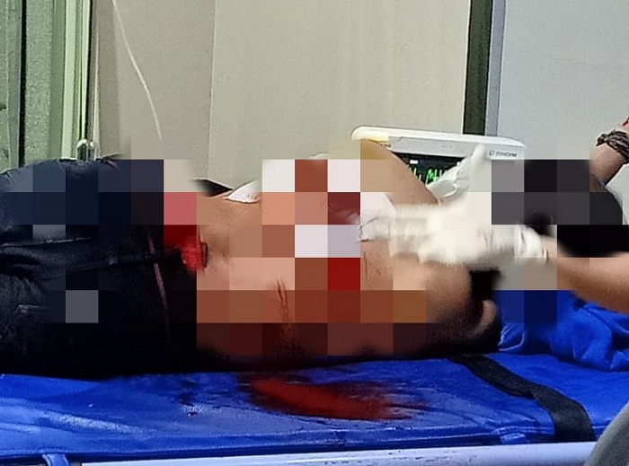 Ahmad Fauzi Tewas Dikeroyok 50 Orang Bermotor, Luka Bacok di Punggung hingga Robek Tembus Paru
