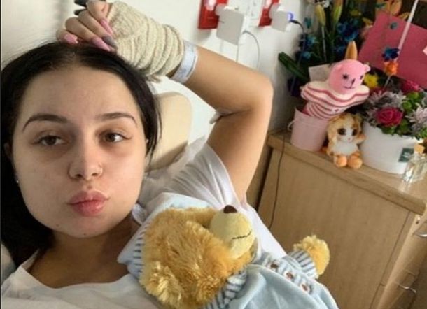 Awalnya Dikira Flu, Gadis Cantik Ini Ternyata Terserang Kanker