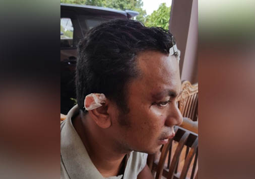 Brigadir Zulfadli, Anggota Polsek Kuansing Yang Berduel Dengan Perampok