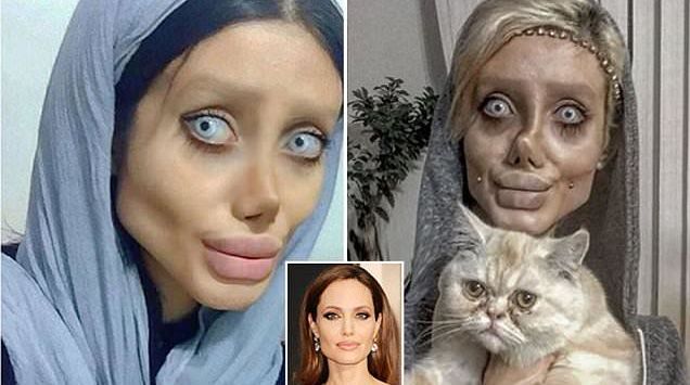 50 Kali Operasi Agar Mirip Angelina Jolie, Gadis Ini Malah Mirip Zombie